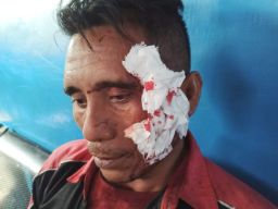 Polisi Buru Pelaku Pembacokan Supir Bus di Perempatan Kebonagung