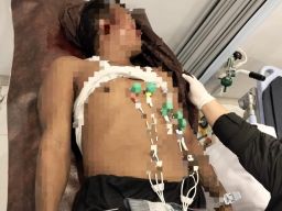 Pondok Pesantren Dalwa III Makan Korban. Pekerja Proyek Tewas Terjatuh