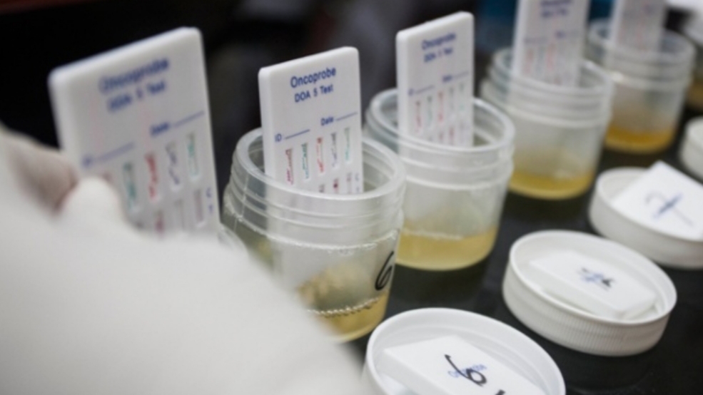 Ilustrasi alat tes narkoba (istimewa)