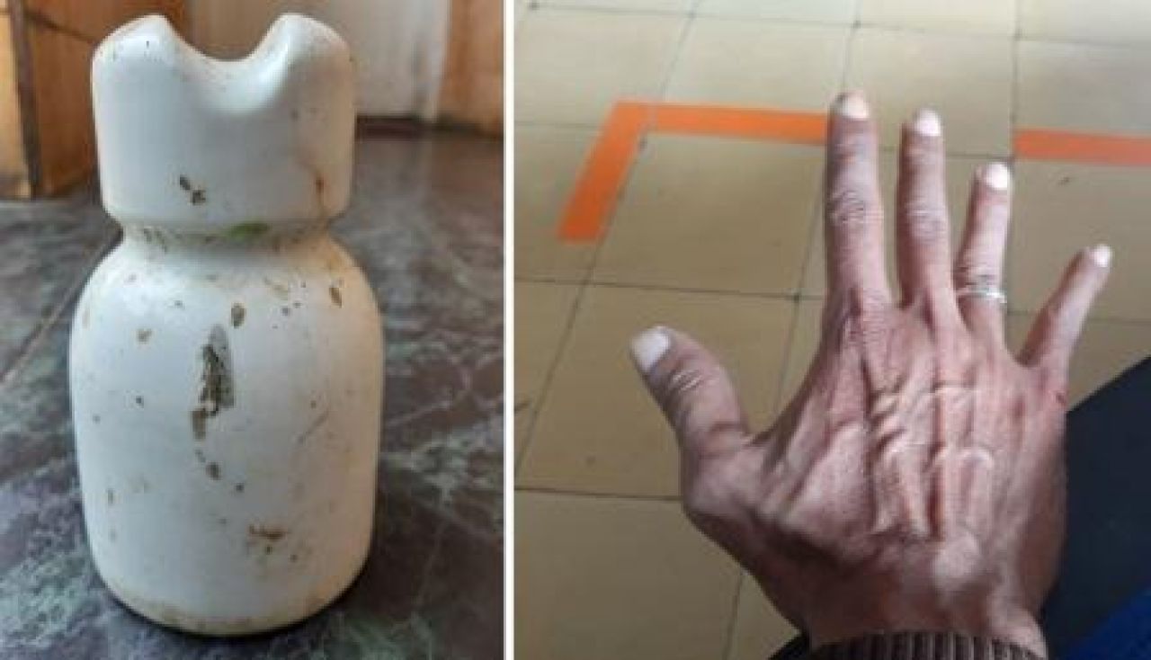 Luka di tangan Kikik, dan barang bukti