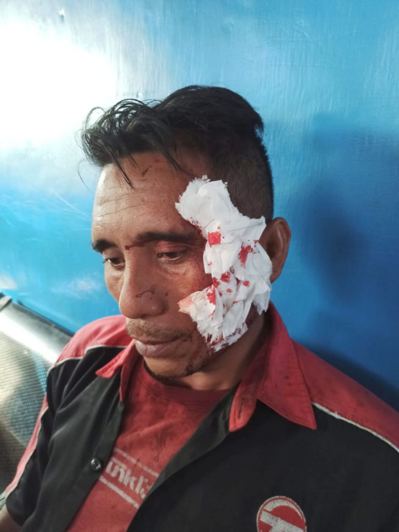 ES sopir bus korban pembacokan yang diduga dilakukan seorang preman