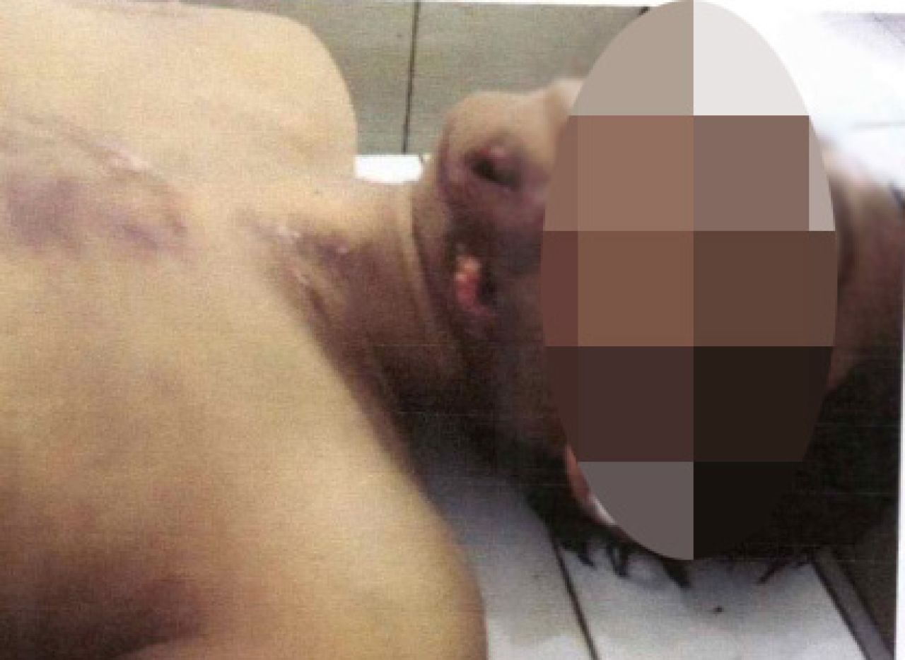 Bekas luka yang dianggap janggal